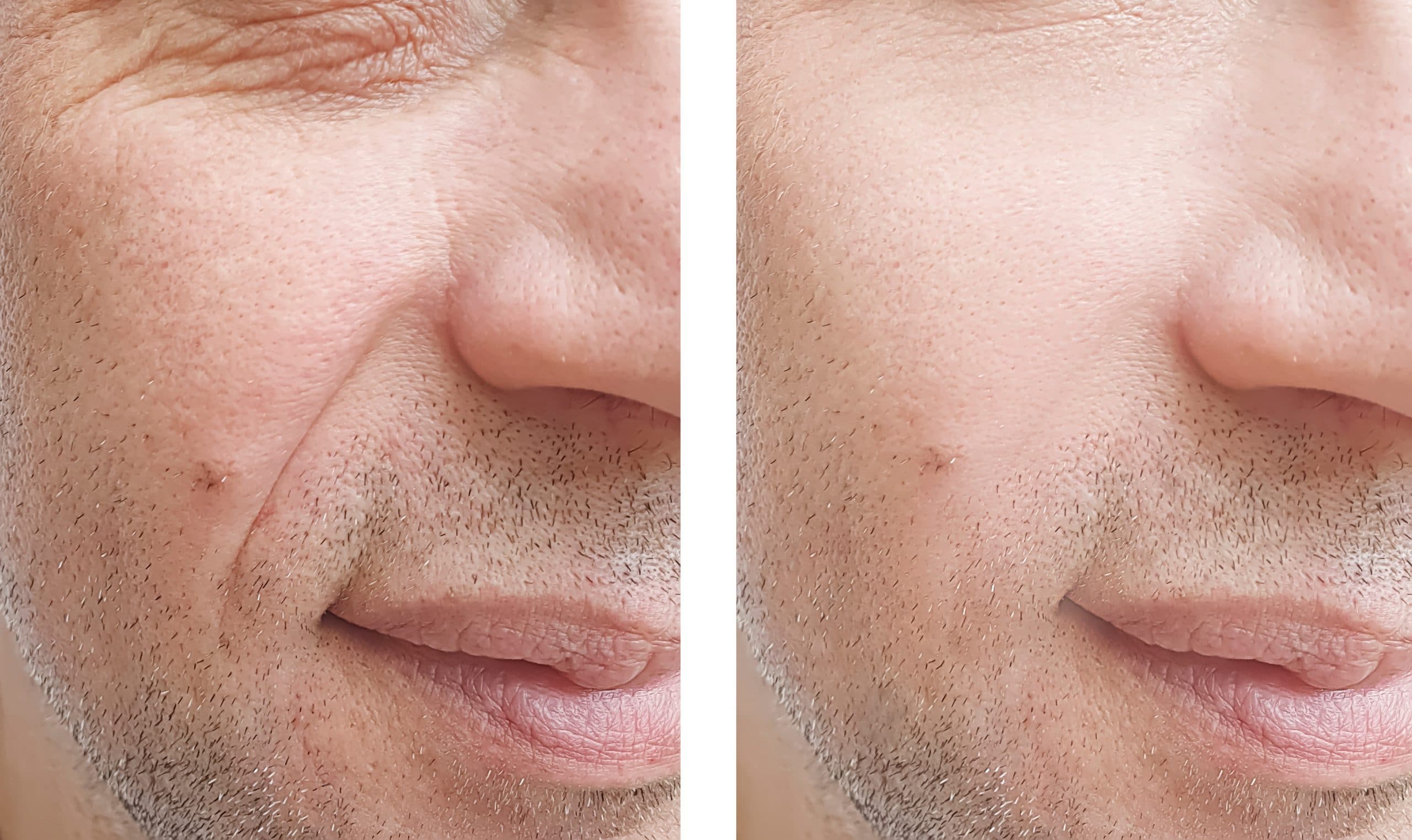 Tévhitek és tények az esztétikai orvoslásról