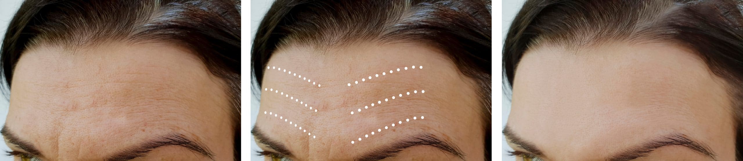 Tévhitek és tények az esztétikai orvoslásról