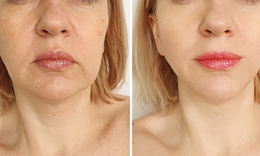 Tévhitek és tények az esztétikai orvoslásról