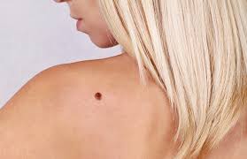 Fedezd fel időben az árulkodó jeleket!