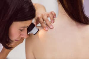 womagic_melanoma