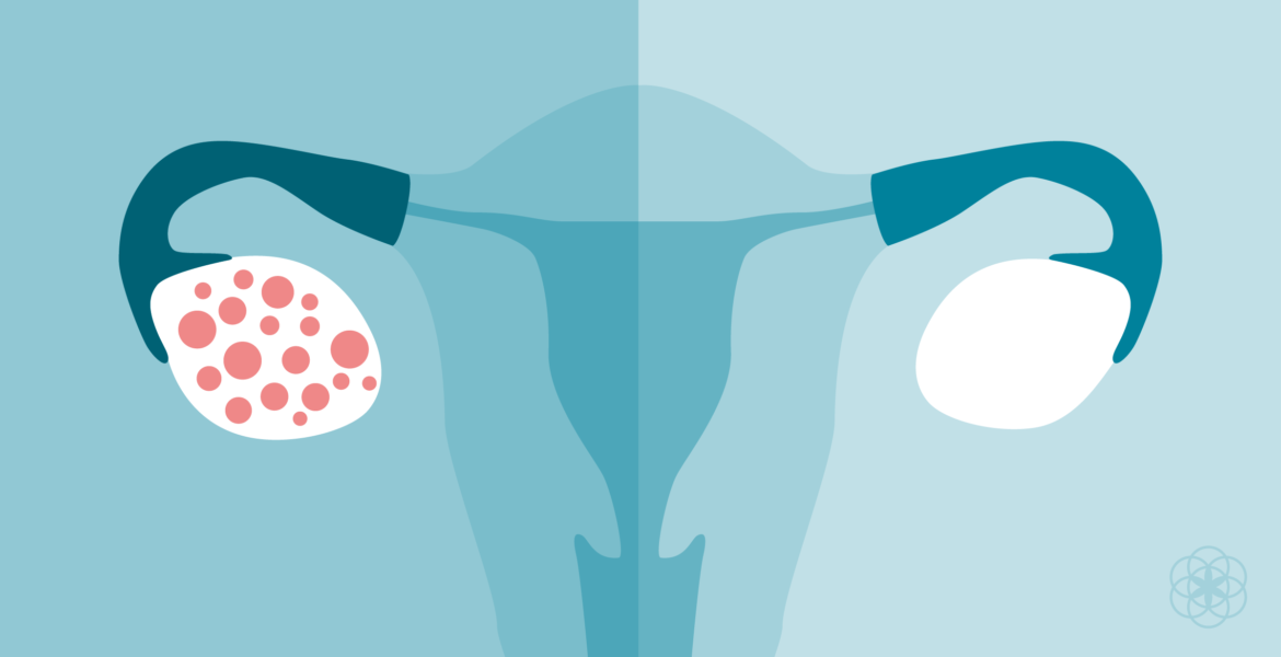 Netamin PCOS / Inzulinrezisztencia + Fogyás válogatáscsomag - Netamin Webshop